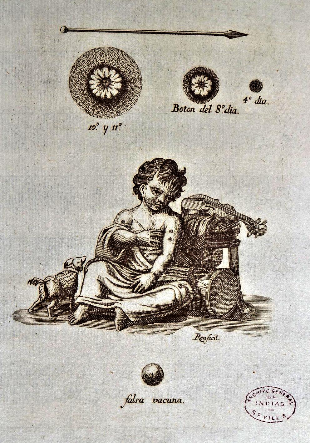 AGI, grabado que ilustra la aplicación de con 3 botones
